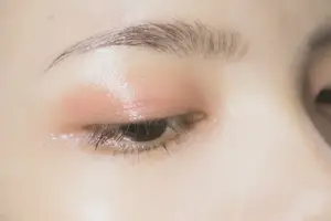急救知识:眼球出血怎么办? 急救知识:眼球出血怎么办?