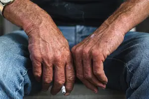 省钱除皱,注射费用大大降低! 省钱除皱,注射费用大大降低!