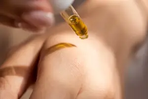 痤疮不再困扰,快速解决疑难! 痤疮不再困扰,快速解决疑难!