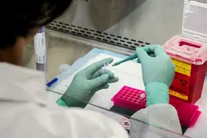 鉴别阴性和未检出,保障健康交易! 鉴别阴性和未检出,保障健康交易!