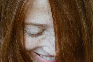 粉刺VS痘痘:你真的知道他们的区别吗? 粉刺VS痘痘:你真的知道他们的区别吗?