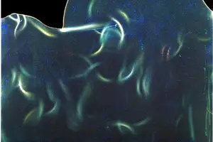 风湿疼痛、告别困扰!专业治疗药助力 风湿疼痛、告别困扰!专业治疗药助力