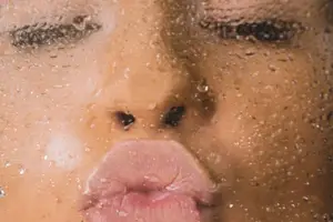 轻松治愈蝴蝶斑，重获无瑕肌肤