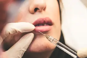 新美容技术:消除抬头纹! 新美容技术:消除抬头纹!