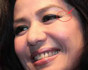 脸上皱纹怎么去？ 脸上长皱纹怎么办？怎样去皱纹吗？