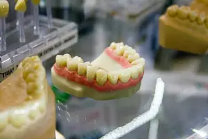 火烤瓷,多重选择,让你的微笑更完美! 火烤瓷,多重选择,让你的微笑更完美!