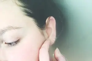 美丽不疼痛,双眼皮无负担 美丽不疼痛,双眼皮无负担