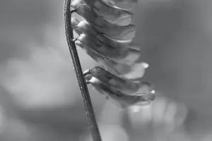 止牙龈出血，远离口腔疾病！