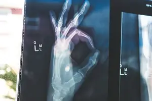 柴胡,帮助你健康,舒缓压力 柴胡,帮助你健康,舒缓压力