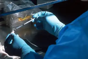 疑似阵发性睡眠性血红蛋白尿？快速诊断！