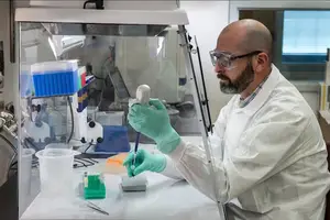 解密红斑狼疮起源：探秘致病真相