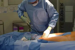 零负担升级美胸，让抽脂隆胸一步到位！