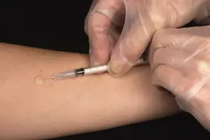 预防结核病必备!结核菌素促销中! 预防结核病必备!结核菌素促销中!