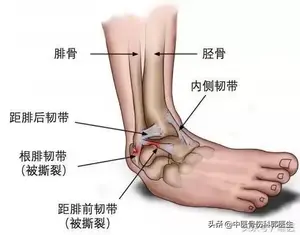 常见的运动损伤及处理方式？ 运动损伤，怎么恢复？