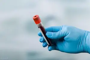 高血脂的治疗方法有哪些？ 高血脂 治疗