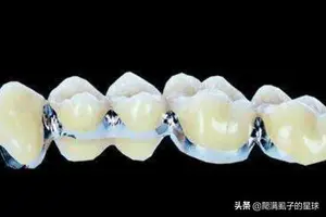 补牙什么材料比较好？ 补牙材料及价格？