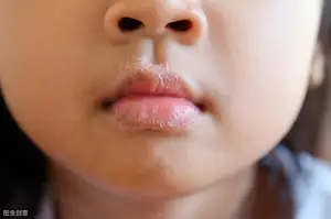 肝不好有那些表现？ 肝不好有什么症状有哪些表现