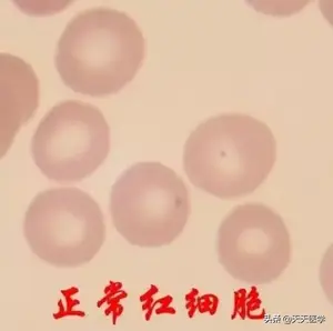 贫血应该怎么补吃什么好？ 贫血怎么补最好？