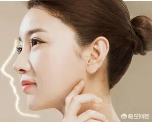 鼻部整形有哪些？ 鼻子整容