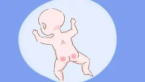 宝宝有这几种症状，是乳糖消化不良了，不重视会影响他发育