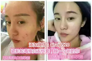 瓷肌使用方法，肌肤暗黄干燥怎么办 快速祛雀斑祛痘的小窍门