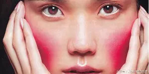 红血丝，你需要注意的一些事！