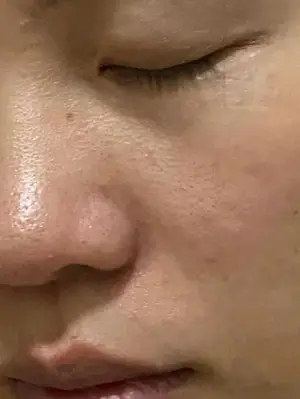 “毒瘤芬太尼，如何打击禁药泛滥？”