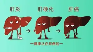 肝脏结节是恶性的吗？是不是要手术切除？看完此文你自己都会治了