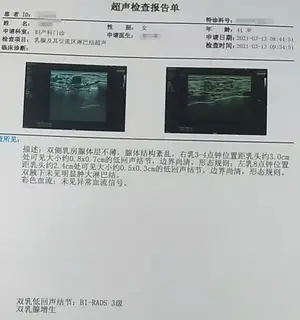 肝通，病不来！一则小药方，疏肝散结，值得学习