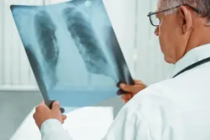 肺结核早期有4个症状，预防2条传染途径是对付肺结核的最好方式