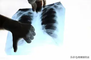 白肺到底是什么？有这些征兆之后，病毒可能就已经进入肺部了