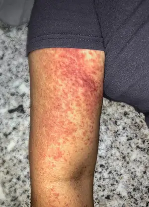 警惕，这种网红止疼药别再用了
