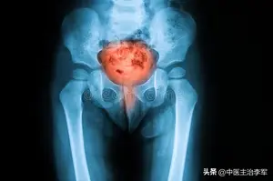 几块钱的龙胆泻肝丸，清热利湿，还能治疗这5种病，一次讲明白