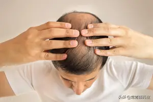 非那雄胺服用3个月至10年会怎么样?几组数据,分别告诉你答案 非那雄胺服用3个月至10年会怎么样?几组数据,分别告诉你答案