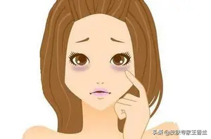 吃什么可以去黑眼圈？ 黑眼圈怎么能去掉？