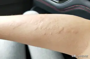 便宜又好用的维C银翘片，不仅清热解毒治感冒 还可以治疗这5种病