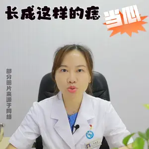 警惕！长成这样的“痣”不是痣，而是瘤！#黑色素瘤