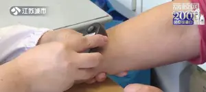 一颗小痣可能会要命！掌握“ABCDE”原则，肉眼判断黑色素瘤！