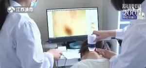 一颗小痣可能会要命！掌握“ABCDE”原则，肉眼判断黑色素瘤！