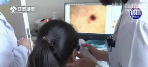 一颗小痣可能会要命！掌握“ABCDE”原则，肉眼判断黑色素瘤！