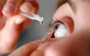 不正确使用眼药水导致角膜破损？谈谈眼药水的正确用法