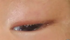 宝宝眼屎多，又黄又黏稠，真的是上火吗？
