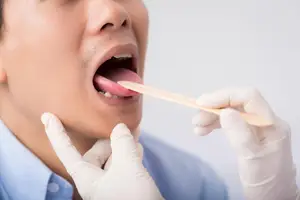 扁桃体炎该如何治疗？一定要做手术切除吗？不如试试解热消炎胶囊