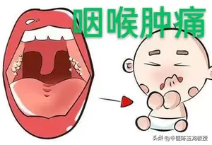 仲景护嗓名方，三味药温阳化痰，轻松搞定咽炎、喉炎、扁桃体炎