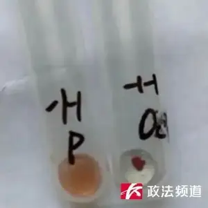 比“熊猫血”更稀有，你知道类孟买血型吗？