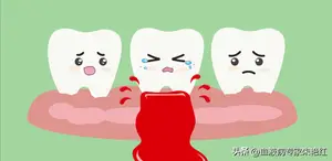 再生障碍性贫血不治疗能活多久？可以自愈吗？