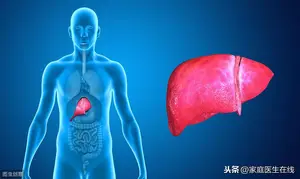转氨酶偏高是什么意思？两个可能性，会导致转氨酶升高