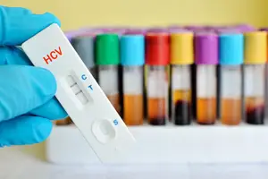 你可能不知道的丙肝感染相关小知识