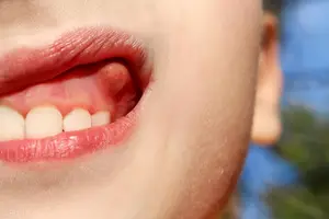 体内有湿热，该如何祛除？4个不同祛湿热的中成药