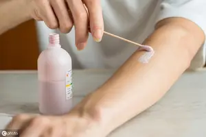 蚊子咬、痱子痒、皮肤淹了？10 块钱一瓶的它安全又管用